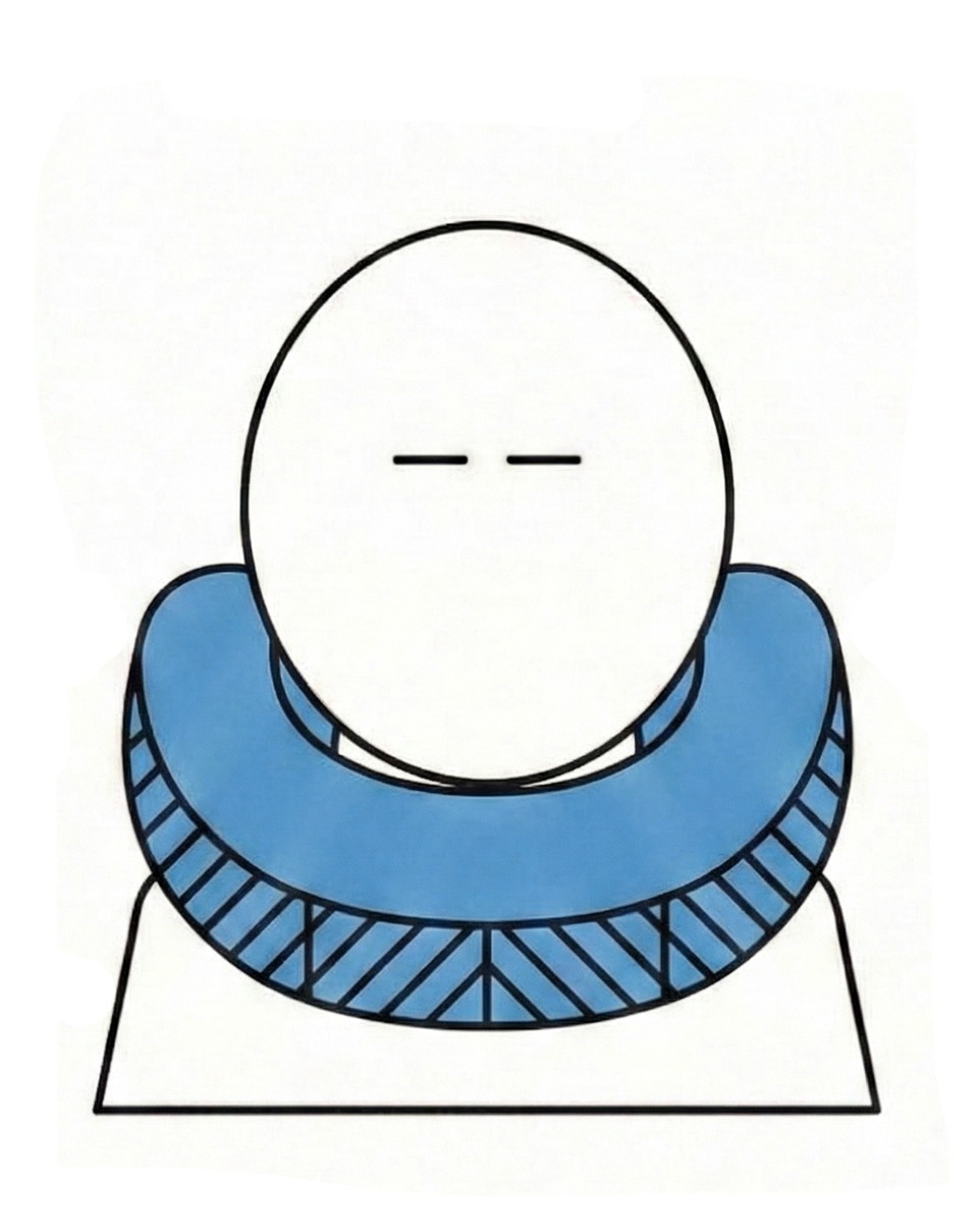 Rotated: Chin Support